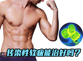 阳江专业治疗传染性软疣医院