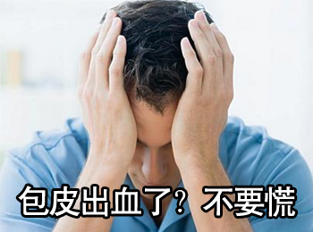 阳江专业治疗包皮出血医院