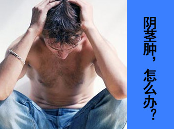阳江专业治疗生殖器畸形医院