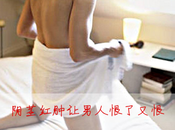 阳江专业治疗阴茎红肿医院