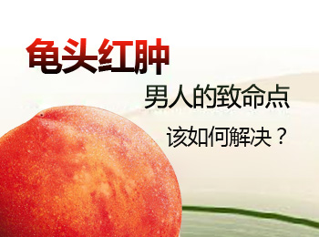 阳江专业治疗龟头红肿医院
