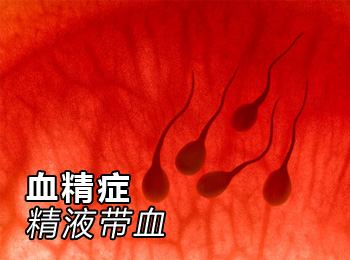 阳江专业治疗血精症医院