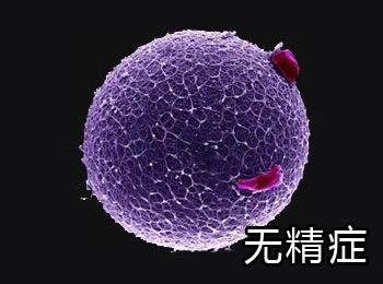 阳江专业治疗无精症医院