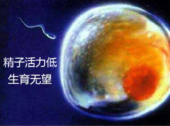 阳江专业治疗精子活力低医院