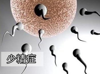 阳江专业治疗少精症医院