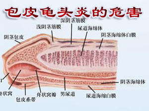 龟头炎带来的极大危害