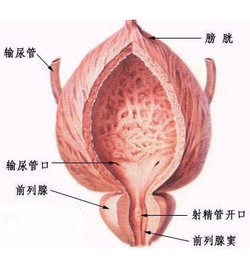 前列腺增生