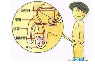 睾丸炎并发症