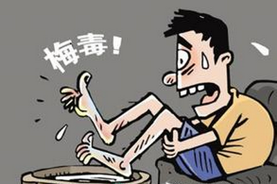 梅毒