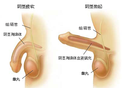 阳痿