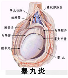 阳江男性患有睾丸炎是什么原因
