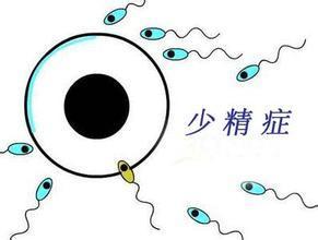 弱精症的危害
