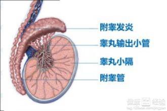 睾丸附睾炎的症状