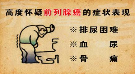 前列腺癌的症状