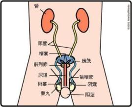 前列腺钙化的治疗