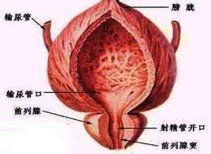 防治前列腺钙化妙招