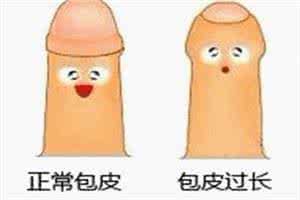 包茎也会引发早泄吗?